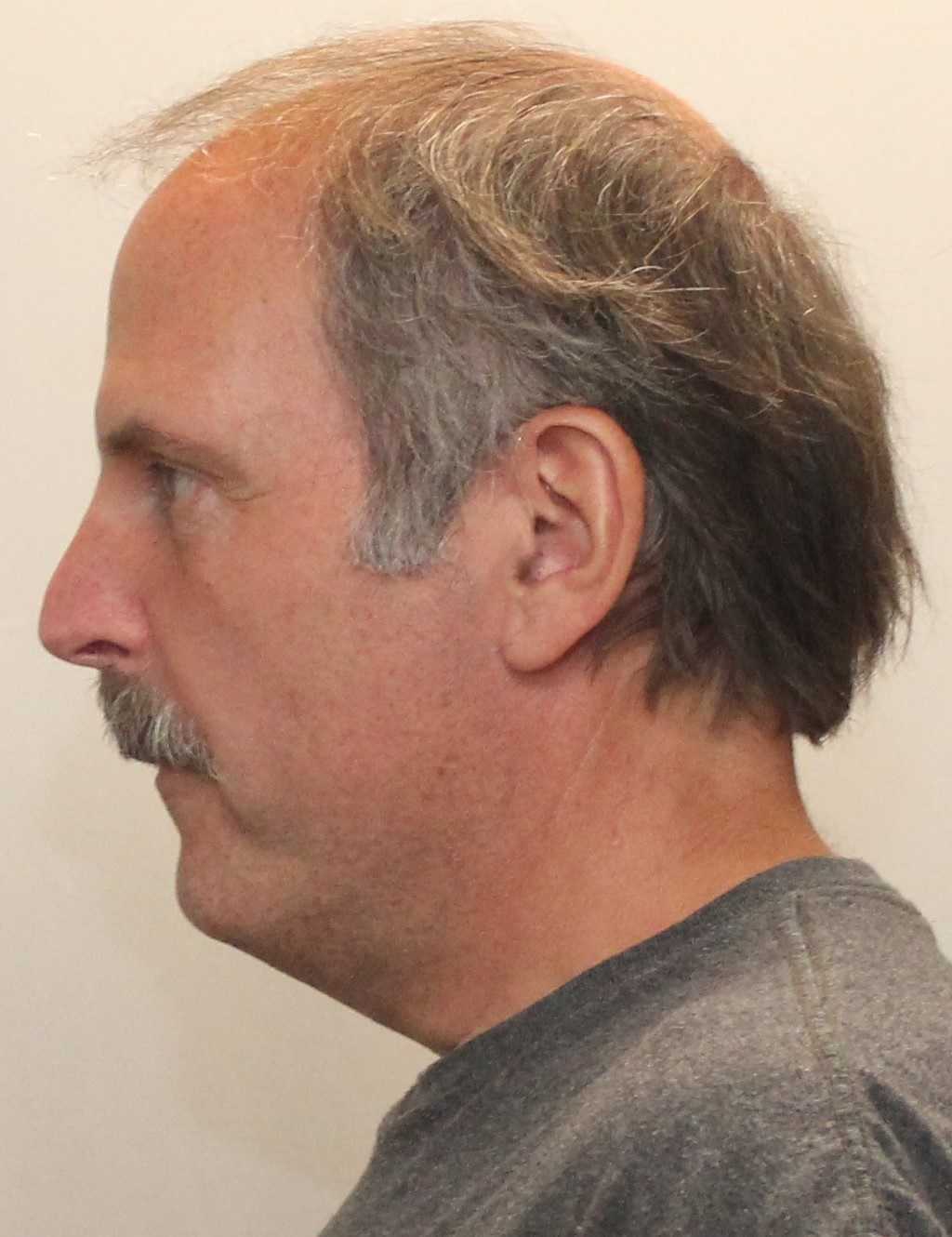 Mugshot Side